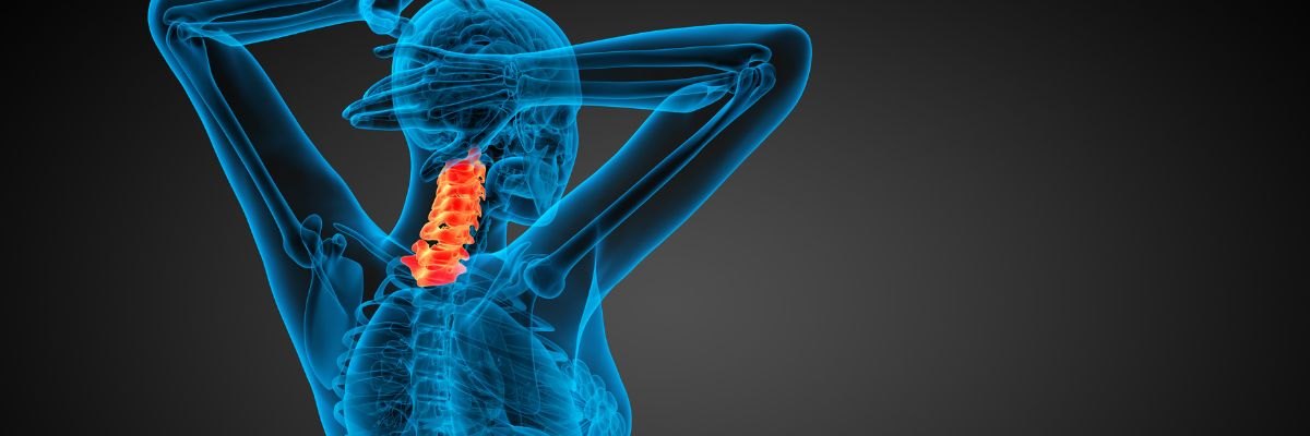 Cervical Decompression Surgery: Simple Guide for Neck Pain Relief